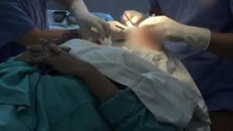 Trách nhiệm của cơ sở thẩm mỹ khi khách hàng bị tử vong sau phẫu thuật thẩm mỹ